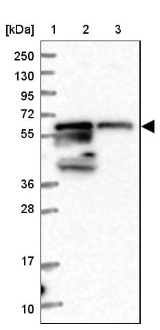 <B>Immunoblotting</B><BR/>Anti-ME3: <B>Cat. No. HPA038473</B>: <BR/><B>Lane</B><BR/>1. Marker [kDa] 250, 130, 95, 72, 55, 36, 28, 17, 10<BR/>2. Human cell line RT-4<BR/>3. Human cell line U-251 MG sp