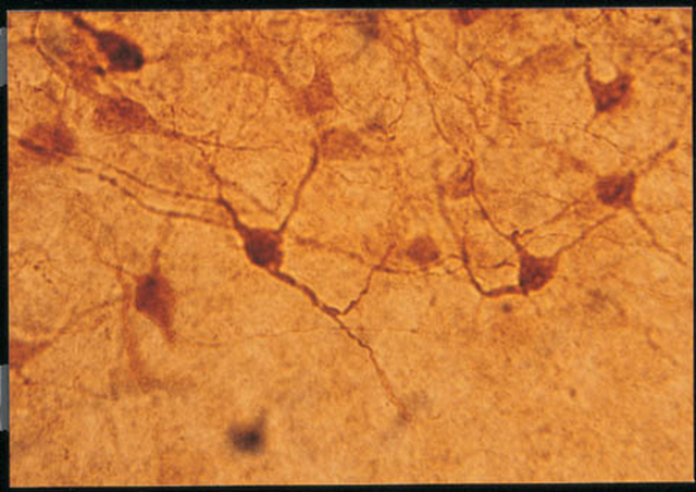 Rabbit anti-Adenosine Deaminase (Catalog Number AB176). Rat superior colliculus; adenosine deaminase neurons with dorsally directed