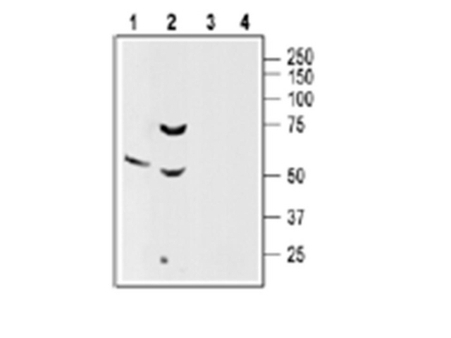 Western blotting of rat brain (1,3) and rat pancreas (2,4) lysate:  <br /> 1,2. AB15558, 1:200. <br /> 3,4. AB15558, preincubated with the control peptide antigen.