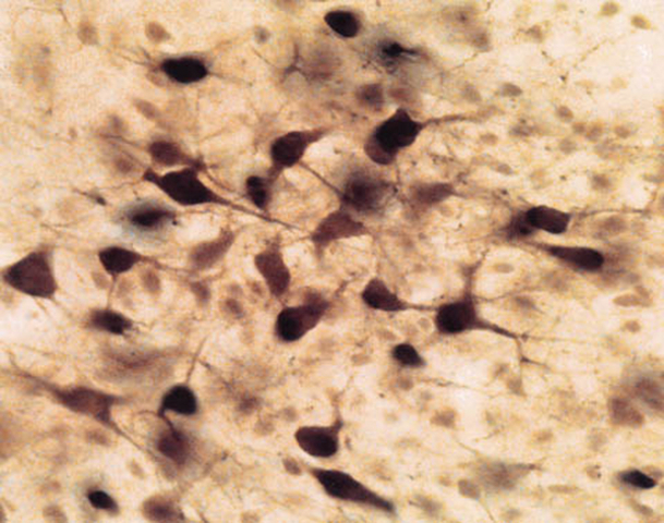 Sheep anti-Choline Acetyltransferase (Catalog Number AB1582) staining of rat brain stem motor neurons.