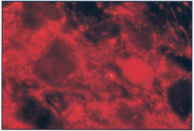  Sheep anti-Choline Acetyltransferase (Catalog Number AB1582) staining of guinea pig myenteric plexus, cell bodies and nerve fibers.