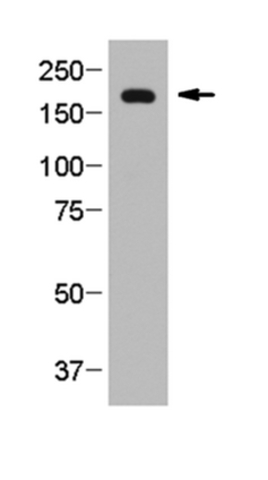 Western Blotting Analysis:<br />Representative lot data.<br />Proteins in mouse retina post-nuclear lysate were seperated by electrophoresis (~25 µg or ~0.3 retina equivalent per lane) without prior heating, transferred to nitrocellulose membrane, blocked with 5% milk in TBST, and probed with Cat. No. MABN1841, Anti-TRPM1, clone 545H5 (1 µg/mL) overnight at 4°C. Proteins were visualized using an anti-mouse IgG secondary antibody conjugated to HRP and a chemiluminescence detection system.<br />Arrow indicates TRPM1 (~180 kDa).<br />(Image courtesy of Dr. Melina A. Agosto, Baylor College of Medicine, Houston, TX)