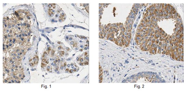 Immunohistochemistry Analysis:<br />Representative lot data.<br />Formalin Fixed Paraffin Embedded (FFPE) human testis (Fig. 1) and human hyperplastic prostate (Fig. 2) tissues were processed using heat-induced epitope retrieval (HIER). Immunostaining was performed using a 1:50 dilution of Cat. No. ABC244, Anti-PATE1. Reactivity was detected using an Anti-Rabbit secondary antibody and HRP-DAB. Cytoplasmic staining of Leydig and germ cells in human testis and cytoplasmic staining of epithelial cells in human hyperplastic prostate tissues was observed