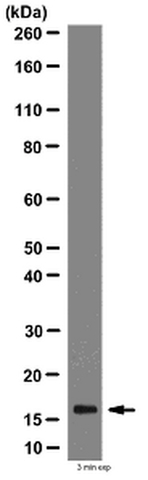 Immunohistochemistry Analysis: Representative lot data. Paraffin-embedded colorectal carcinoma tissue was prepared using heat-induced epitope retrieval in citrate buffer, pH 6.0. Immunostaining was performed using a 1:500 dilution of Cat. No. AB2970, Anti-MAP1LC3B2. Reactivity was detected using the IHC-Select Detection Kit (Cat. No. DAB050). Staining pattern appears as nuclear (some cells) and diffusive in the plasma membrane.