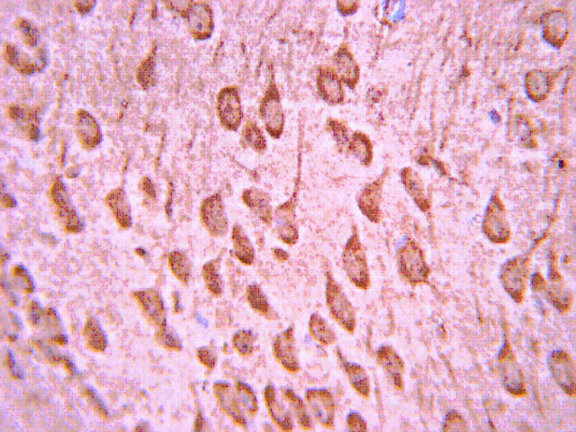 Immunohistochemistry Analysis: <br />Representative lot data.<br />Paraffin-embedded mouse embryo E12.5+ tissue was prepared using heat-induced epitope retrieval in citrate buffer, pH 6.0. Immunostaining was performed using a 1:500 dilution of Cat. No. AB10535, Anti-Neurogenin-3 (rabbit polyclonal). Reactivity was detected using the IHC-Select Detection Kit (Cat. No. DAB050). Immunoreactivity is expressed in embryonic brain in synaptic processes. Staining pattern apears to be cytoplasmic.