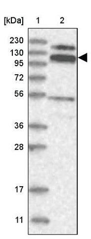 <B>Immunoblotting</B><BR/>Anti-RBM15B: <B>Cat. No. HPA036645</B>: <BR/><B>Lane</B><BR/>1. Marker [kDa] 230, 130, 95, 72, 56, 36, 28, 17, 11<BR/>2. Human cell line RT-4