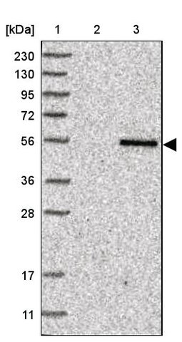 <B>Immunoblotting</B><BR/>Anti-TYSND1: <B>Cat. No. HPA030304</B>: <BR/><B>Lane</B><BR/>1. Marker [kDa] 230, 130, 95, 72, 56, 36, 28, 17, 11<BR/>2. Human cell line RT-4<BR/>3. Human cell line U-251 MG sp