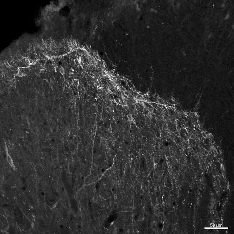 Lamina I staining of NKR1 Neurons in IHC using Anti-Substance P Receptor antibody  (Millipore Catalogue No. AB15810).