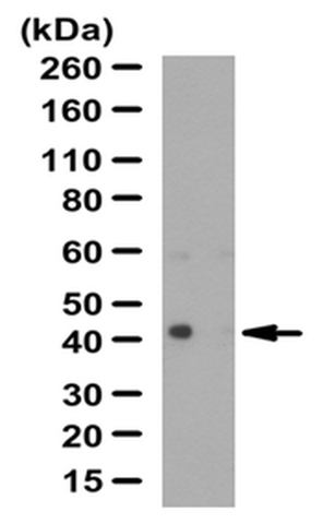 Western Blotting Analysis: <br />Representative lot data. <br />Human heart tissue lysate was probed with Cat. No. ABD37, Anti-REM 2 (GTP-binding protein) (0.5 µg/mL). <br />Proteins were visualized using a Donkey Anti-Rabbit IgG secondary antibody conjugated to HRP and a chemiluminescence detection system. <br />Arrow indicates REM2 (~42 kDa). Note: An uncharacterized band appears at ~62 kDa in some lysates.