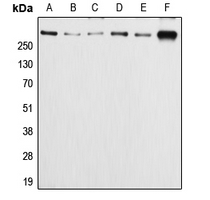 Western blot analysis of APC (pS2054) expression in HeLa (A); Caco2 (B); SW480 (C); MCF7 (D); SP2/0 (E); PC12 (F) whole cell lysates.