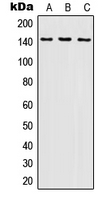 Western blot analysis of SHIP1 expression in THP1 (A); NAMALWA (B); Ramos (C) whole cell lysates.