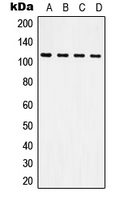 Western blot analysis of CD61 expression in HeLa (A); Raw264.7 (B); NIH3T3 (C); H9C2 (D) whole cell lysates.