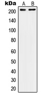 Western blot analysis of CD104 expression in A431 (A); SW480 (B) whole cell lysates.