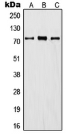 Western blot analysis of ITIH1 expression in A549 (A); mouse lung (B); rat kidney (C) whole cell lysates.