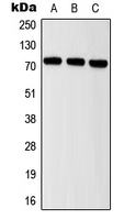 Western blot analysis of ITIH2 expression in MCF7 (A); mouse brain (B); rat brain (C) whole cell lysates.