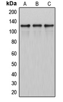 Western blot analysis of ITPKB expression in HeLa (A); SP2/0 (B); H9C2 (C) whole cell lysates.
