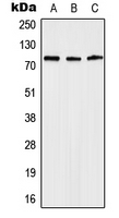 Western blot analysis of Anosmin expression in Jurkat (A); mouse heart (B); rat heart (C) whole cell lysates.