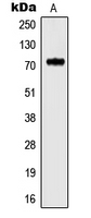 Western blot analysis of Kv3.4 expression in rat brain (A) whole cell lysates.