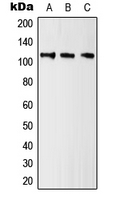 Western blot analysis of Kv10.1 expression in HeLa (A); NIH3T3 (B); H9C2 (C) whole cell lysates.