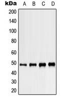 Western blot analysis of Kir3.4 expression in MCF7 (A); Jurkat (B); Raw264.7 (C); PC12 (D) whole cell lysates.