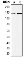 Western blot analysis of KCNMA1 expression in Caski (A); rat brain (B) whole cell lysates.