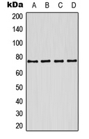 Western blot analysis of Kv7.1 expression in MCF7 (A); A431 (B); mouse brain (C); rat brain (D) whole cell lysates.