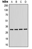 Western blot analysis of CD158b1 expression in MDAMB231 (A); Jurkat (B); mouse liver (C); H9C2 (D) whole cell lysates.