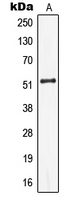 Western blot analysis of Cytokeratin 13 expression in Jurkat (A) whole cell lysates.