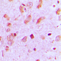 Immunohistochemical analysis of Cytokeratin 13 staining in human brain formalin fixed paraffin embedded tissue section. The section was pre-treated using heat mediated antigen retrieval with sodium citrate buffer (pH 6.0). The section was then incubated with the antibody at room temperature and detected using an HRP conjugated compact polymer system. DAB was used as the chromogen. The section was then counterstained with haematoxylin and mounted with DPX.
