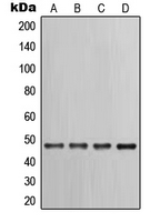 Western blot analysis of Cytokeratin 17 expression in PC12 (A); HeLa (B); A431 (C); NIH3T3 (D) whole cell lysates.