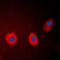 Immunofluorescent analysis of Cytokeratin 17 staining in HeLa cells. Formalin-fixed cells were permeabilized with 0.1% Triton X-100 in TBS for 5-10 minutes and blocked with 3% BSA-PBS for 30 minutes at room temperature. Cells were probed with the primary antibody in 3% BSA-PBS and incubated overnight at 4 C in a humidified chamber. Cells were washed with PBST and incubated with a DyLight 594-conjugated secondary antibody (red) in PBS at room temperature in the dark. DAPI was used to stain the cell nuclei (blue).