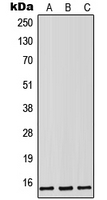 Western blot analysis of Lutropin beta expression in HEK293T (A); SP2/0 (B); PC12 (C) whole cell lysates.
