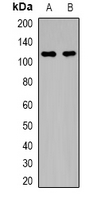 Western blot analysis of MYPT1 (pT696) expression in HEK293T PMA-treated (A); HEK293T UV-treated (B) whole cell lysates.