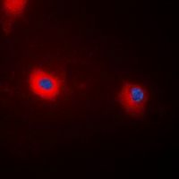 Immunofluorescent analysis of MYPT1 (pT696) staining in HEK293T cells. Formalin-fixed cells were permeabilized with 0.1% Triton X-100 in TBS for 5-10 minutes and blocked with 3% BSA-PBS for 30 minutes at room temperature. Cells were probed with the primary antibody in 3% BSA-PBS and incubated overnight at 4 deg C in a hidified chamber. Cells were washed with PBST and incubated with a DyLight 594-conjugated secondary antibody (red) in PBS at room temperature in the dark. DAPI was used to stain the cell nuclei (blue).