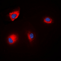 Immunofluorescent analysis of ANAPC1 (pS688) staining in HEK293T cells. Formalin-fixed cells were permeabilized with 0.1% Triton X-100 in TBS for 5-10 minutes and blocked with 3% BSA-PBS for 30 minutes at room temperature. Cells were probed with the primary antibody in 3% BSA-PBS and incubated overnight at 4 deg C in a hidified chamber. Cells were washed with PBST and incubated with a DyLight 594-conjugated secondary antibody (red) in PBS at room temperature in the dark. DAPI was used to stain the cell nuclei (blue).