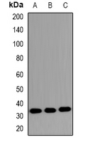 Western blot analysis of MKI67IP (pT234) expression in HeLa (A); NIH3T3 (B); PC12 (C) whole cell lysates.