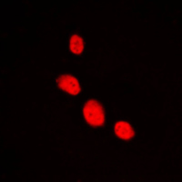 Immunofluorescent analysis of LHX1 staining in HepG2 cells. Formalin-fixed cells were permeabilized with 0.1% Triton X-100 in TBS for 5-10 minutes and blocked with 3% BSA-PBS for 30 minutes at room temperature. Cells were probed with the primary antibody in 3% BSA-PBS and incubated overnight at 4 C in a humidified chamber. Cells were washed with PBST and incubated with a DyLight 594-conjugated secondary antibody (red) in PBS at room temperature in the dark. DAPI was used to stain the cell nuclei (blue).