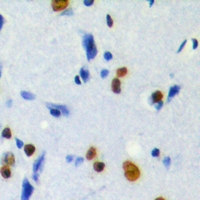 Immunohistochemical analysis of MKI67IP (pT234) staining in human brain formalin fixed paraffin embedded tissue section. The section was pre-treated using heat mediated antigen retrieval with sodium citrate buffer (pH 6.0). The section was then incubated with the antibody at room temperature and detected using an HRP conjugacompact polymer system. DAB was used as the chromogen. The section was then counterstained with haematoxylin and mounted with DPX.