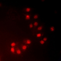 Immunofluorescent analysis of MKI67IP (pT234) staining in HeLa cells. Formalin-fixed cells were permeabilized with 0.1% Triton X-100 in TBS for 5-10 minutes and blocked with 3% BSA-PBS for 30 minutes at room temperature. Cells were probed with the primary antibody in 3% BSA-PBS and incubated overnight at 4 deg C in a hidified chamber. Cells were washed with PBST and incubated with a DyLight 594-conjugated secondary antibody (red) in PBS at room temperature in the dark. DAPI was used to stain the cell nuclei (blue).