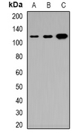 Western blot analysis of Tensin 3 expression in HeLa (A); DLD (B); H9C2 (C) whole cell lysates.