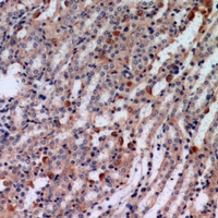 Immunohistochemical analysis of Tensin 3 staining in human kindey formalin fixed paraffin embedded tissue section. The section was pre-treated using heat mediated antigen retrieval with sodium citrate buffer (pH 6.0). The section was then incubated with the antibody at room temperature and detected using an HRP conjugacompact polymer system. DAB was used as the chromogen. The section was then counterstained with haematoxylin and mounted with DPX.