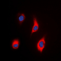 Immunofluorescent analysis of Tensin 3 staining in HeLa cells. Formalin-fixed cells were permeabilized with 0.1% Triton X-100 in TBS for 5-10 minutes and blocked with 3% BSA-PBS for 30 minutes at room temperature. Cells were probed with the primary antibody in 3% BSA-PBS and incubated overnight at 4 deg C in a hidified chamber. Cells were washed with PBST and incubated with a DyLight 594-conjugated secondary antibody (red) in PBS at room temperature in the dark. DAPI was used to stain the cell nuclei (blue).