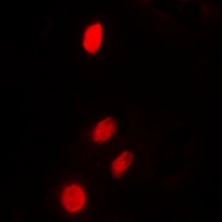 Immunofluorescent analysis of TP53INP2 staining in HeLa cells. Formalin-fixed cells were permeabilized with 0.1% Triton X-100 in TBS for 5-10 minutes and blocked with 3% BSA-PBS for 30 minutes at room temperature. Cells were probed with the primary antibody in 3% BSA-PBS and incubated overnight at 4 deg C in a hidified chamber. Cells were washed with PBST and incubated with a DyLight 594-conjugated secondary antibody (red) in PBS at room temperature in the dark. DAPI was used to stain the cell nuclei (blue).