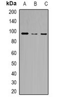 Western blot analysis of ZFP95 expression in HeLa (A); RAW264.7 (B); H9C2 (C) whole cell lysates.