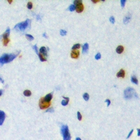 Immunohistochemical analysis of ZFP95 staining in human brain formalin fixed paraffin embedded tissue section. The section was pre-treated using heat mediated antigen retrieval with sodium citrate buffer (pH 6.0). The section was then incubated with the antibody at room temperature and detected using an HRP conjugacompact polymer system. DAB was used as the chromogen. The section was then counterstained with haematoxylin and mounted with DPX.