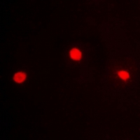 Immunofluorescent analysis of ZFP95 staining in HeLa cells. Formalin-fixed cells were permeabilized with 0.1% Triton X-100 in TBS for 5-10 minutes and blocked with 3% BSA-PBS for 30 minutes at room temperature. Cells were probed with the primary antibody in 3% BSA-PBS and incubated overnight at 4 deg C in a hidified chamber. Cells were washed with PBST and incubated with a DyLight 594-conjugated secondary antibody (red) in PBS at room temperature in the dark. DAPI was used to stain the cell nuclei (blue).