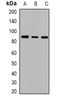 Western blot analysis of Cadherin 20 expression in HeLa (A); mouse liver (B); rat liver (C) whole cell lysates.
