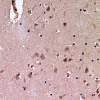 Immunohistochemical analysis of Cadherin 20 staining in human brain formalin fixed paraffin embedded tissue section. The section was pre-treated using heat mediated antigen retrieval with sodium citrate buffer (pH 6.0). The section was then incubated with the antibody at room temperature and detected using an HRP conjugacompact polymer system. DAB was used as the chromogen. The section was then counterstained with haematoxylin and mounted with DPX.
