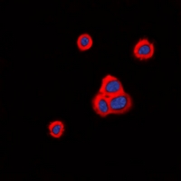 Immunofluorescent analysis of Cadherin 20 staining in HeLa cells. Formalin-fixed cells were permeabilized with 0.1% Triton X-100 in TBS for 5-10 minutes and blocked with 3% BSA-PBS for 30 minutes at room temperature. Cells were probed with the primary antibody in 3% BSA-PBS and incubated overnight at 4 deg C in a hidified chamber. Cells were washed with PBST and incubated with a DyLight 594-conjugated secondary antibody (red) in PBS at room temperature in the dark. DAPI was used to stain the cell nuclei (blue).