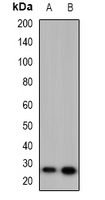 Western blot analysis of 42431 expression in HeLa (A); PC12 (B) whole cell lysates.